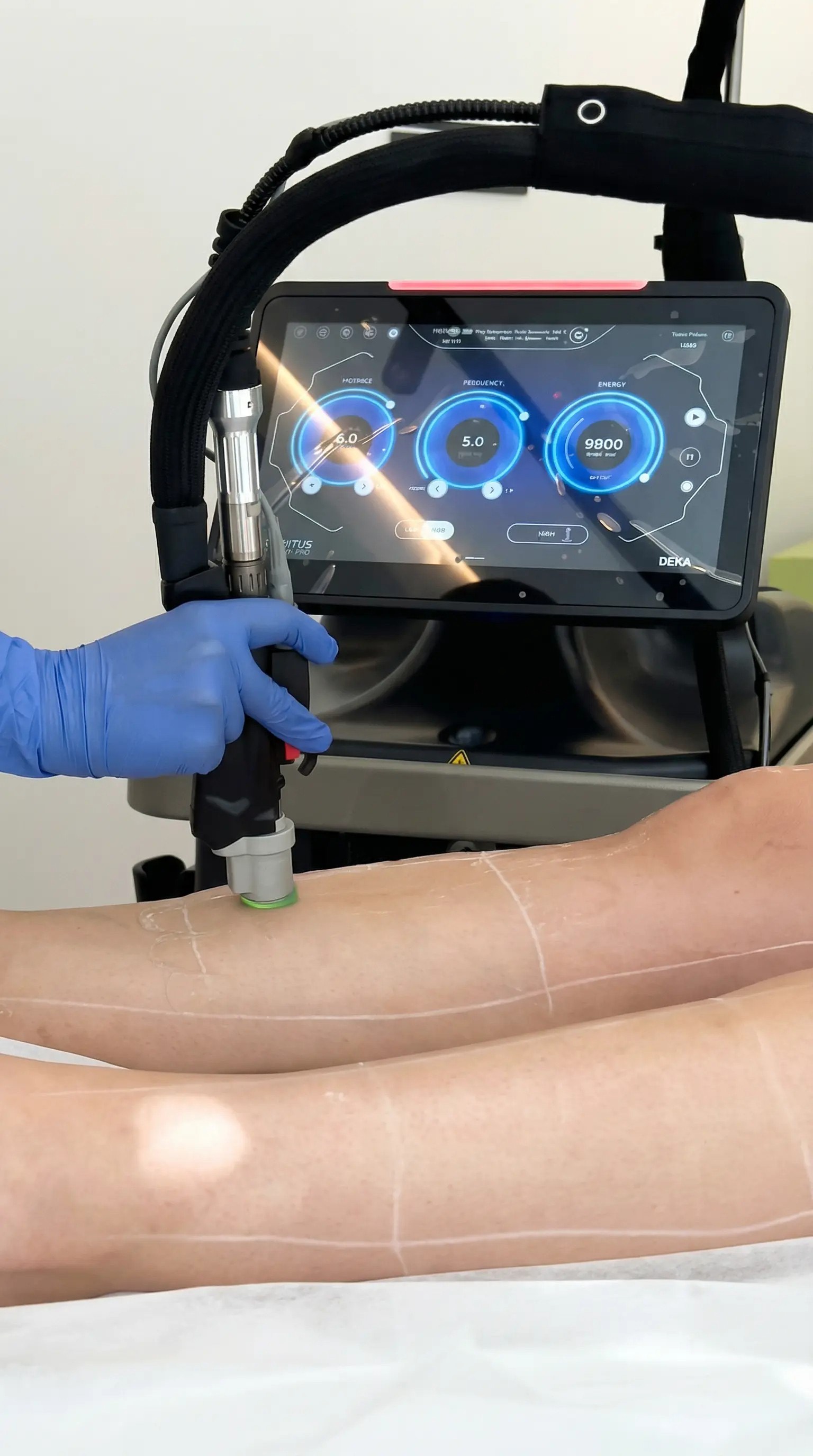 Handstück des medizinischen Alexandritlasers zur schmerzfreien Haarentfernung