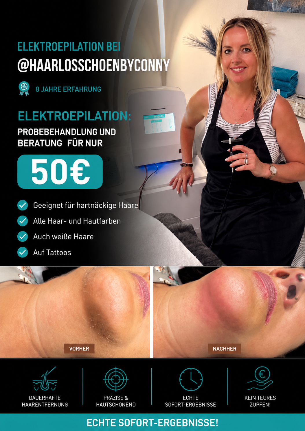 Elektroepilation-Probebehandlung aktuell für nur € 50